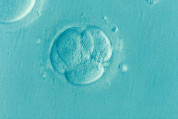 Exploring Short Protocol IVF: A Swift Approach to Fertility Treatment